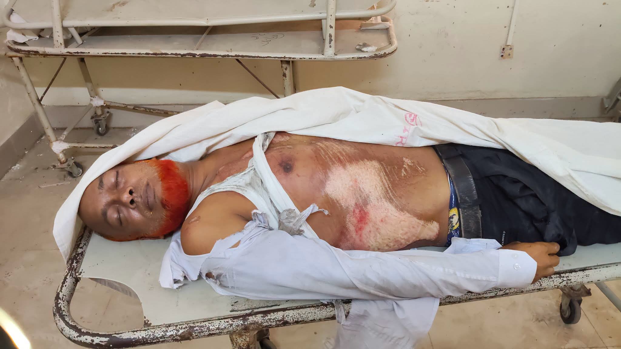 পঞ্চগড়ে ট্রাকের ধাক্কায় ব্যাংকের নিরাপত্তাকর্মীর মৃত্যু